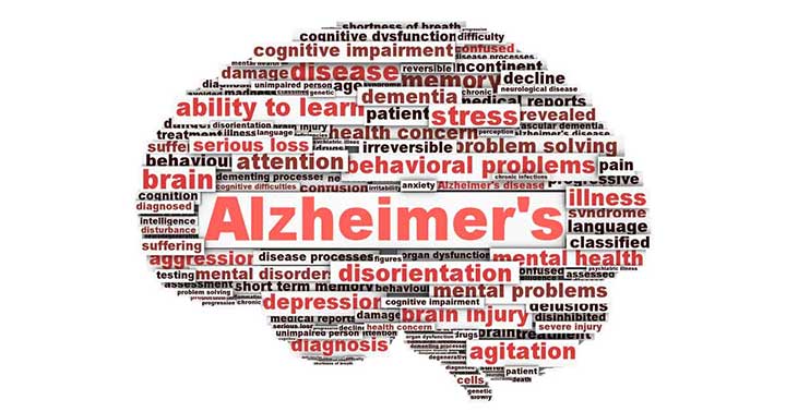 alzheimer disease brain testing