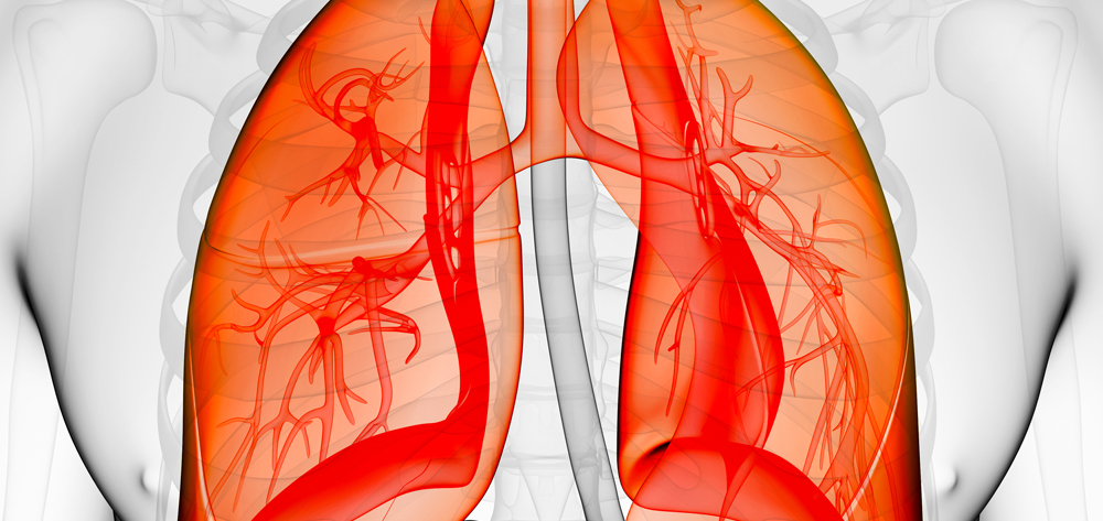 The five P's spell positive outcomes for ARDS patients