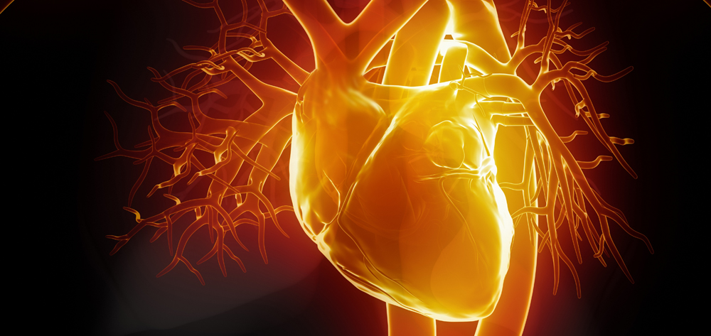 anterior-wall myocardial infarction