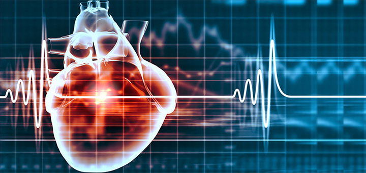 Therapeutic hypothermia after cardiac arrest