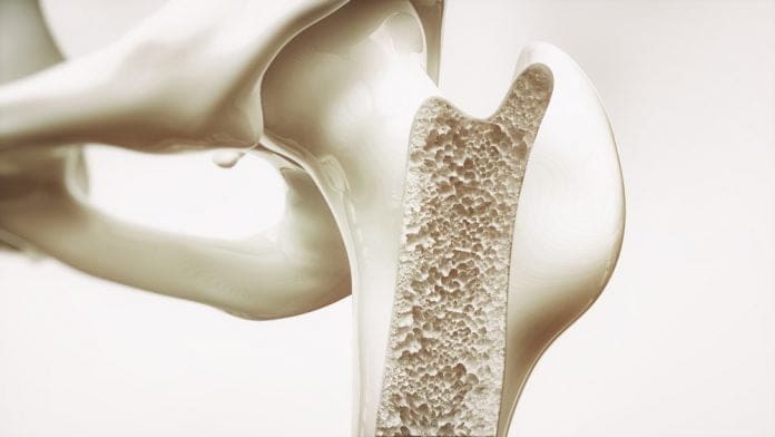 osteop