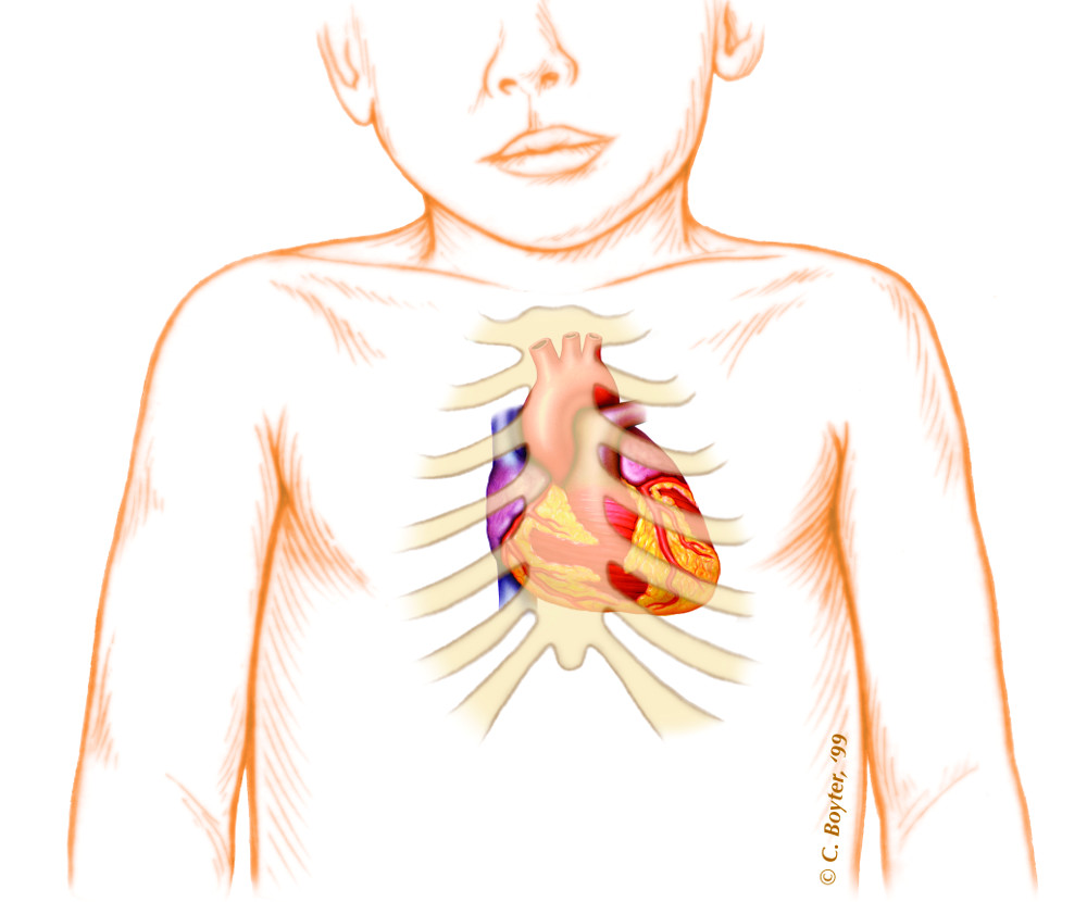 Learning the language of pediatric heart sounds