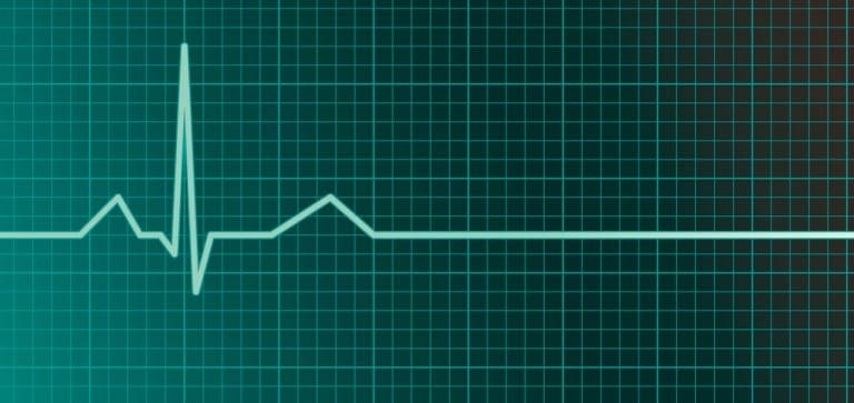 Recognizing ventricular arrhythmias and preventing sudden cardiac death Recognizing ventricular arrhythmias and preventing sudden cardiac death