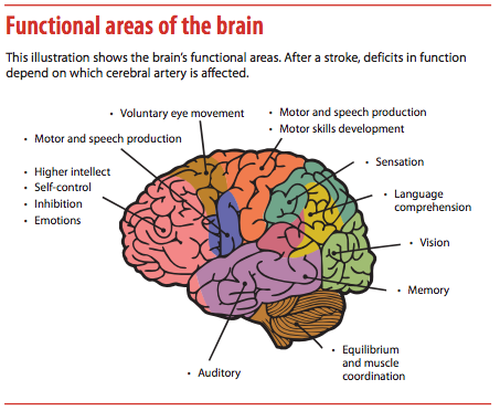 Brain stroke symptoms