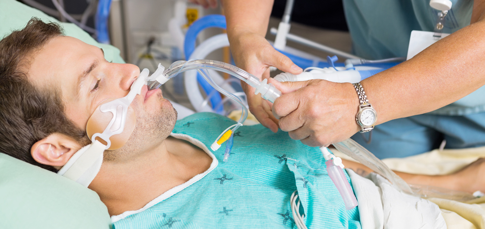 icu patient on ventilator