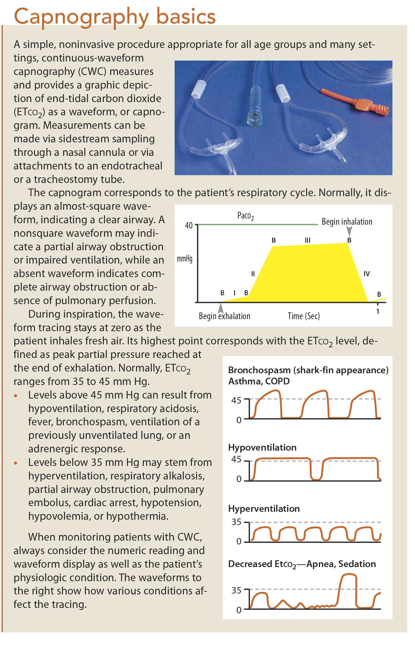 Waveform capnography in the intubated patient - EMCrit Project
