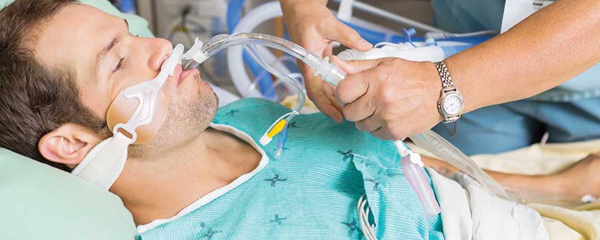 Pneumonia ventilator associated Ventilator Associated