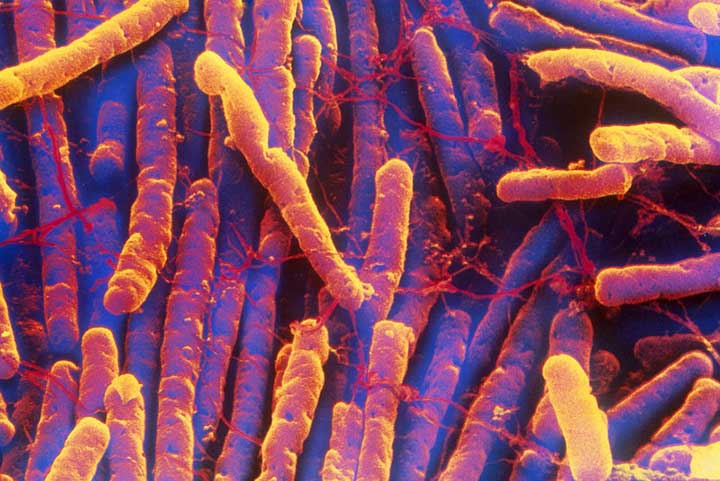 clostridium difficile infection