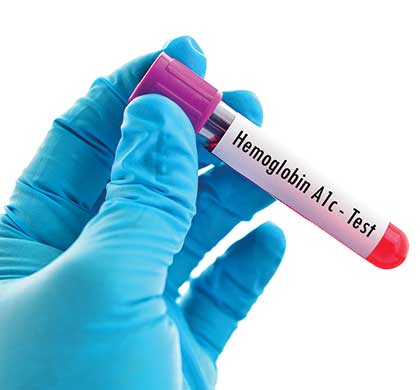 glycemic control glycated hemoglobin A1c test