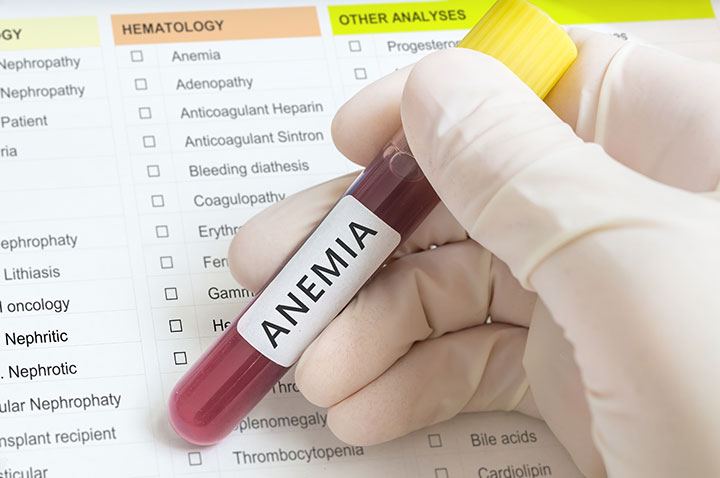 anemia bariatric surgery patient anemia bariatric surgery patient