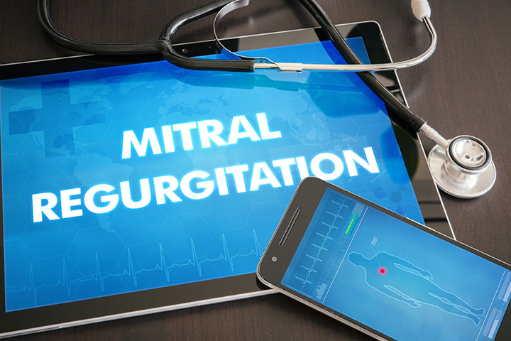 hypertension mitral regurgitation