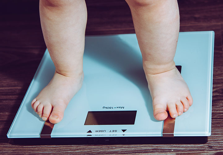 childhood child obesity trend