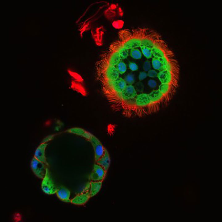 cystic fibrosis drug nasospheroids