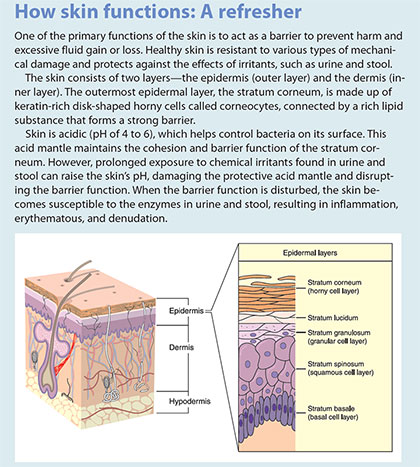 incontinence associated dermatitis management update skin function refresher