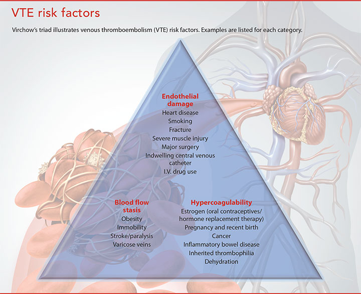 venous thromboembolism troubling events vte risk factor