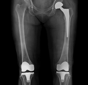 higher readmission rates