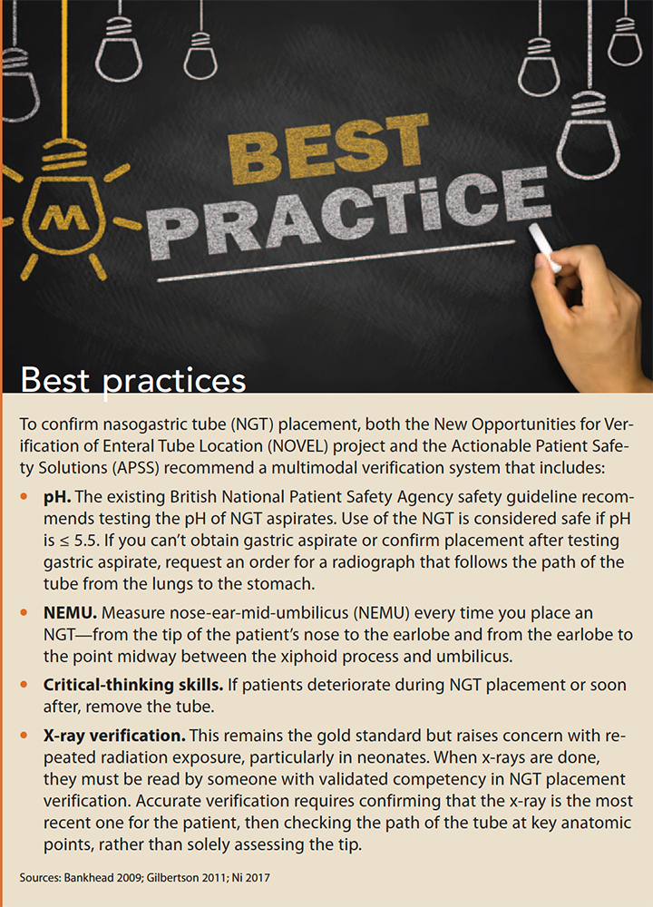 reducing nasogastric tube misplacement best practices