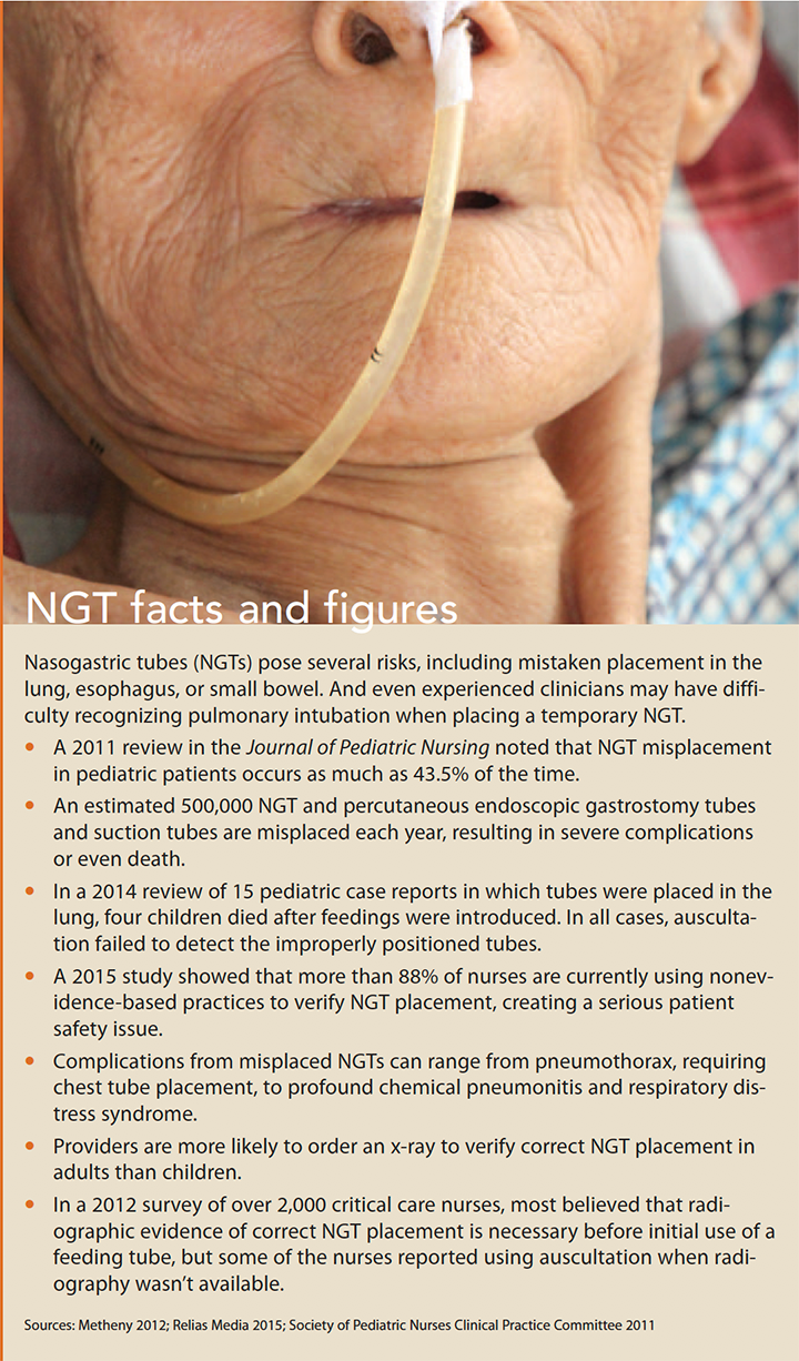 reducing nasogastric tube misplacement facts figures