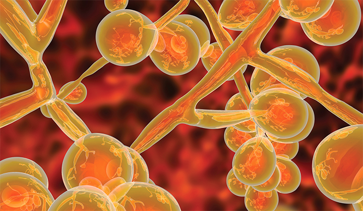 Candida auris: Nurses’ response to an emerging threat