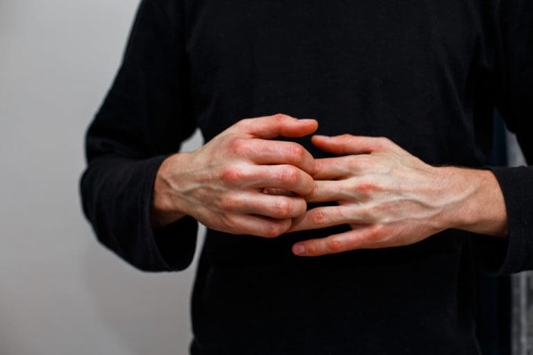 Potential new treatment for atopic dermatitis Potential new treatment for atopic dermatitis