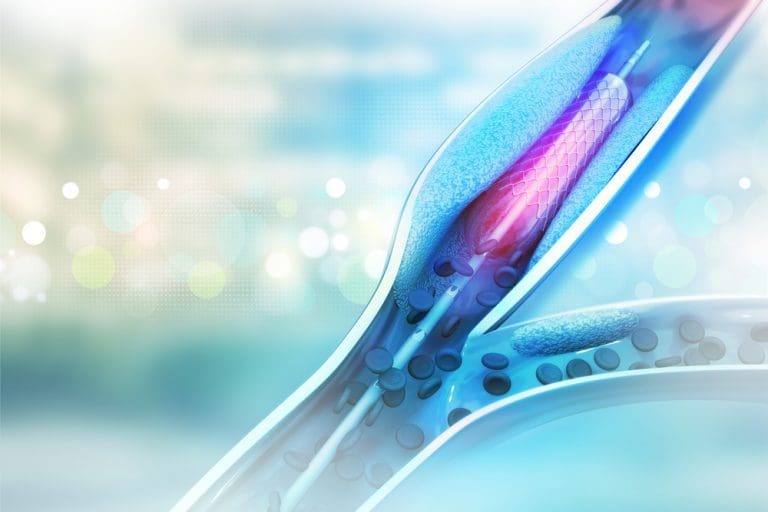 Central vascular access device complications: Central vascular access device complications:
