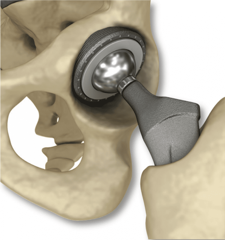 Innovative end-to-end total arthroplasty care Innovative end-to-end total arthroplasty care