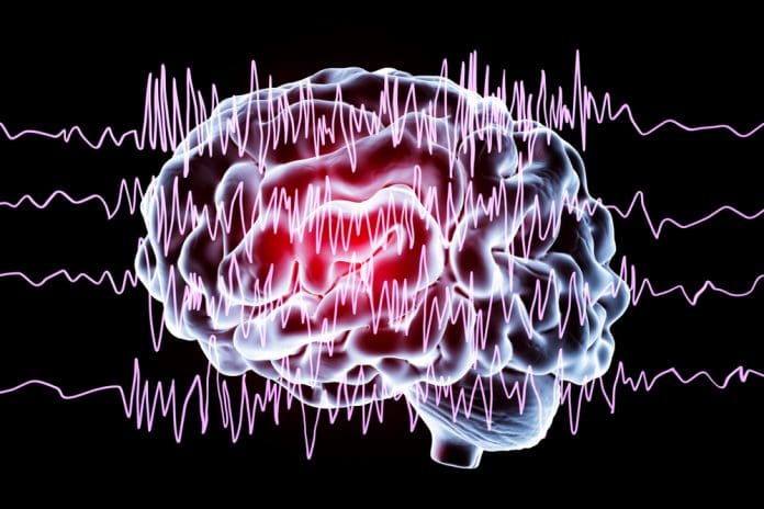 seizure