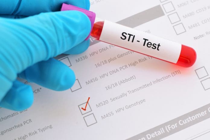 sexually transmitted infections