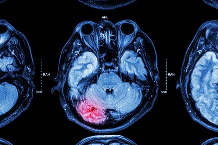 mri
