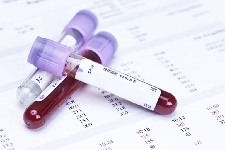 Reducing hemolysis rates Reducing hemolysis rates