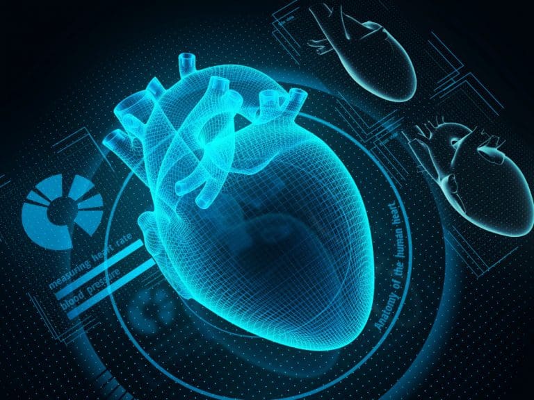 Myocarditis Myocarditis