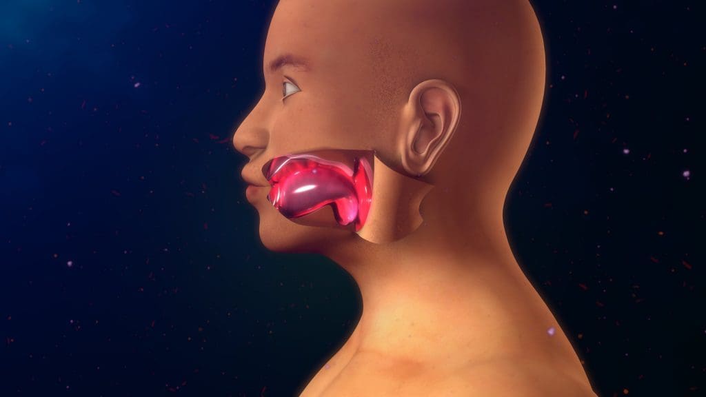 bradykinin induced angioedema