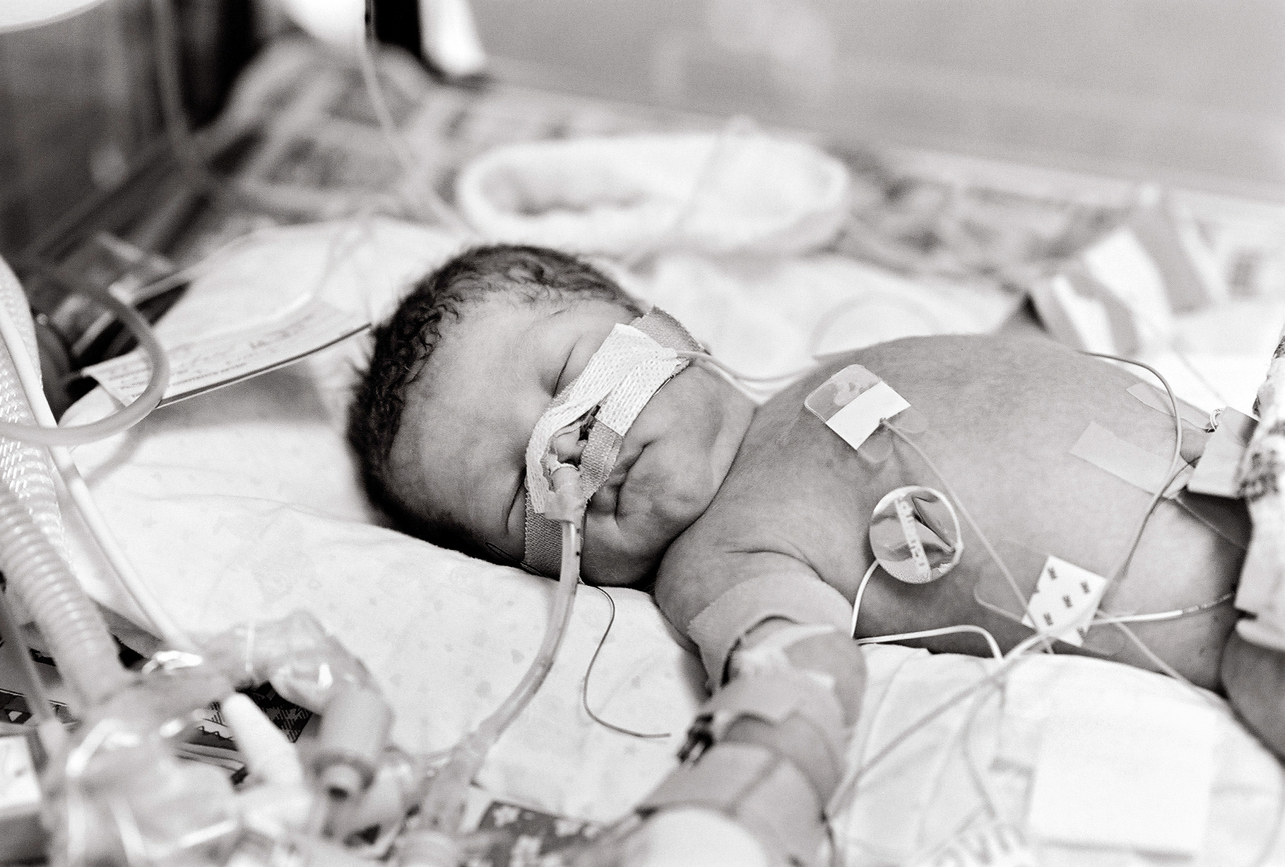 Baby in the NICU