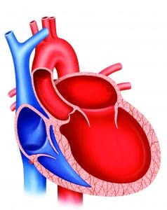 arrhythmogenic-cardiomyopathy