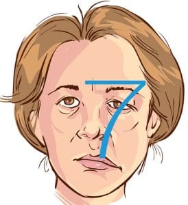 Cranial Nerve - Figure 3