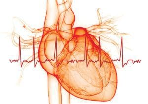 Atrial fibrillation