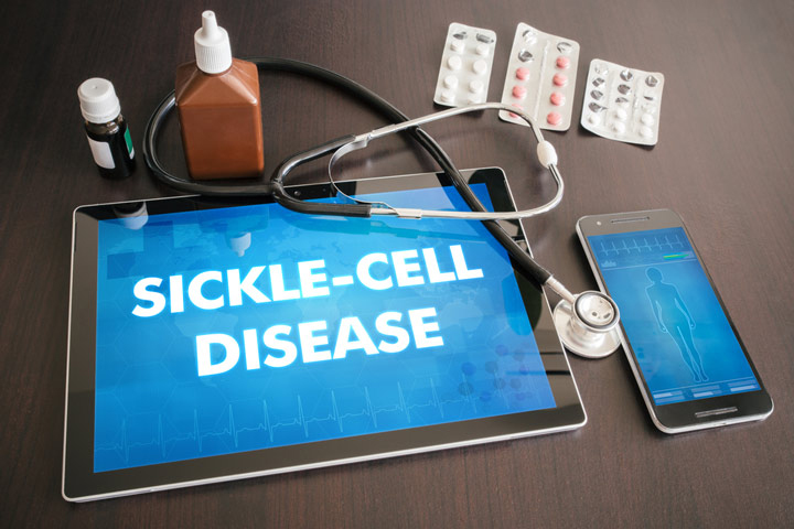 Sickle Cell Crisis