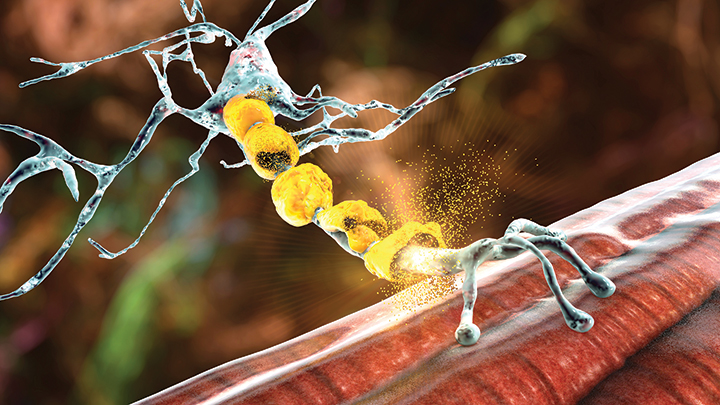 leukoencephalopathy