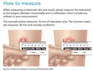 How to measure