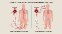 nursing research topics on hypertension