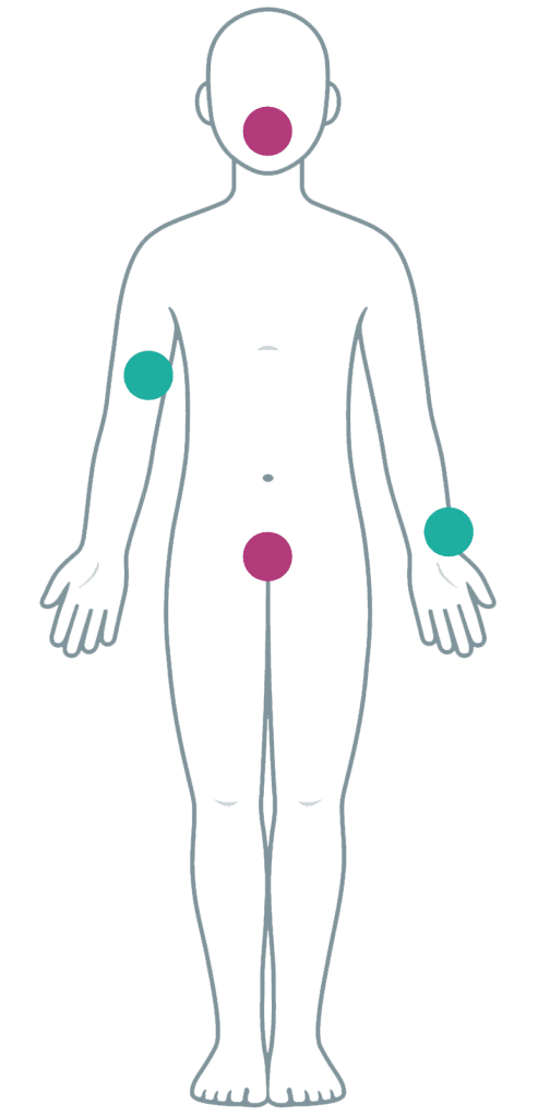 Skin Rigor Skin integrity and steroid medications