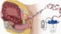 Implementing the JADA® System to Reduce Postpartum Hemorrhage in a ...